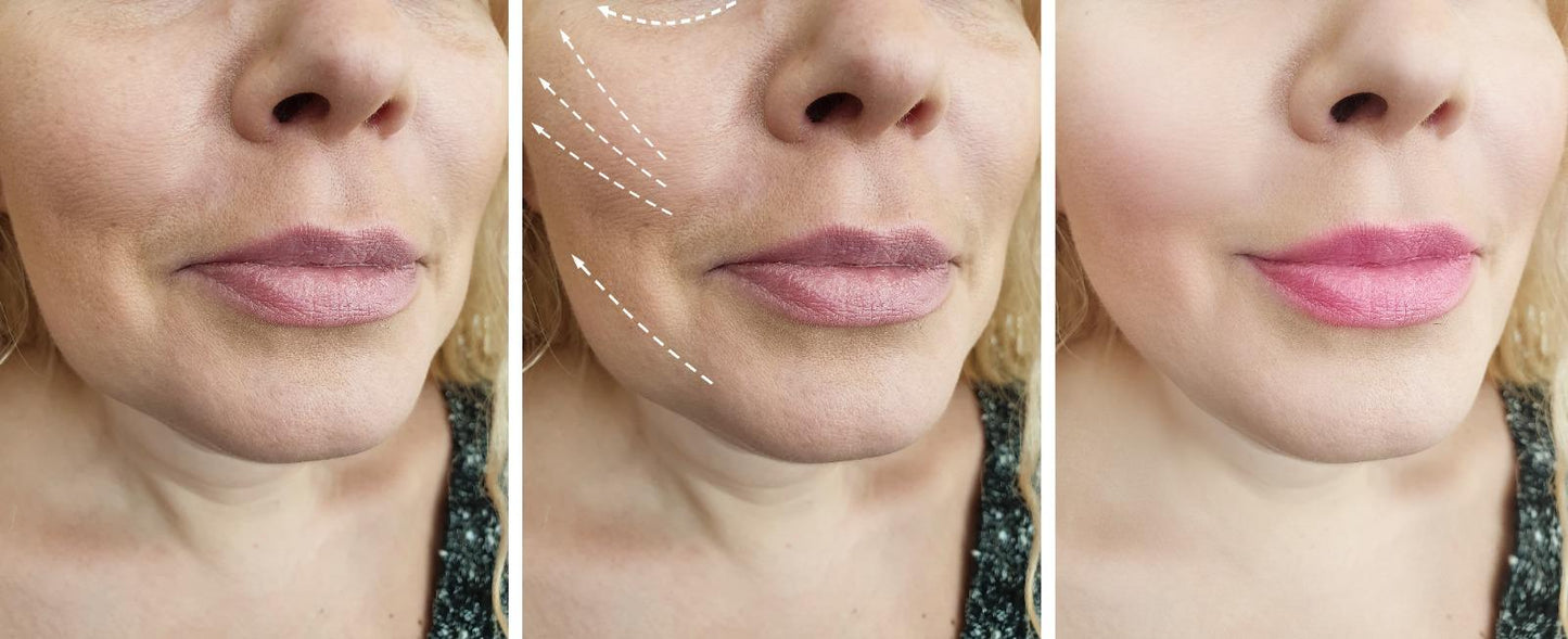 Elixir Lifting Cream