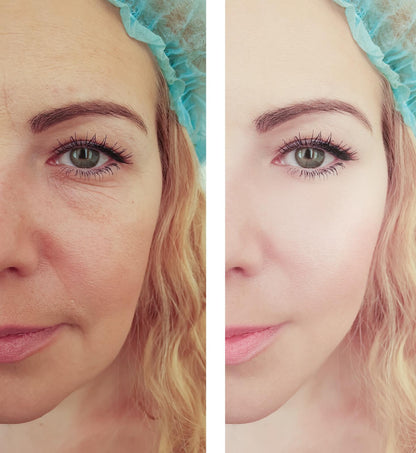 Elixir Lifting Cream